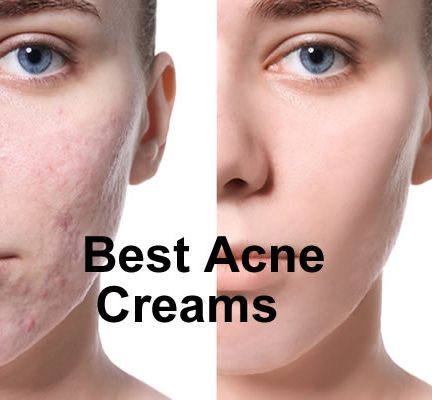 Best Acne Creams in Pakistan