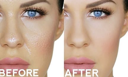 How to Apply Makeup for Oily Skin step by step